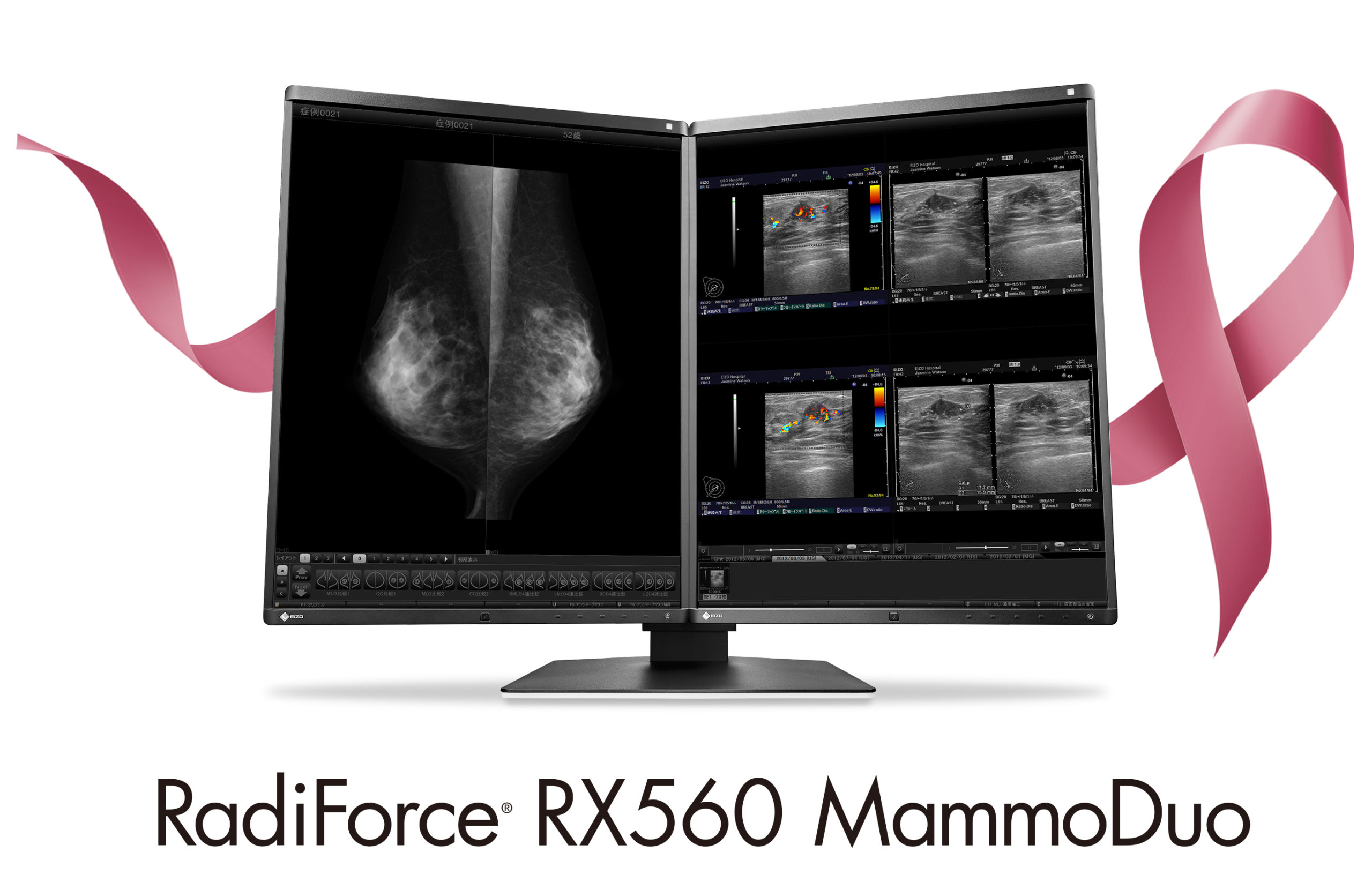 RadiForce RX560 MammoDuo